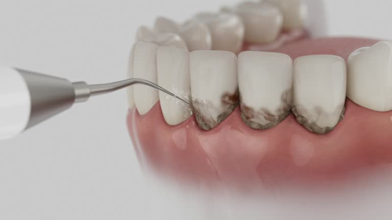 Reliable Emergency Dentist contractor in Drexel, NC by Smile Center Dentistry